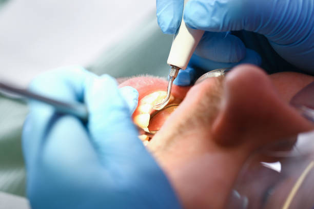 Best Emergency Gum Treatment in Viera East, FL